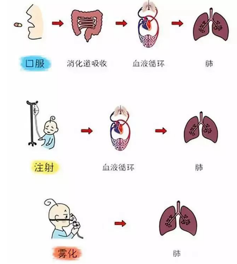 雾化吸入图片原理图片